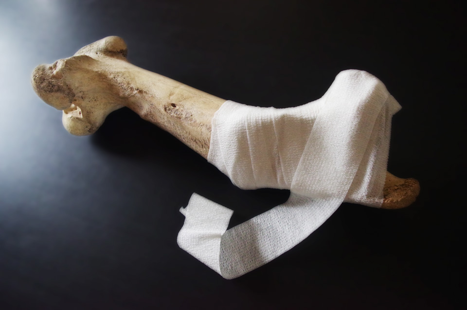 Bandage around the bone for healing death